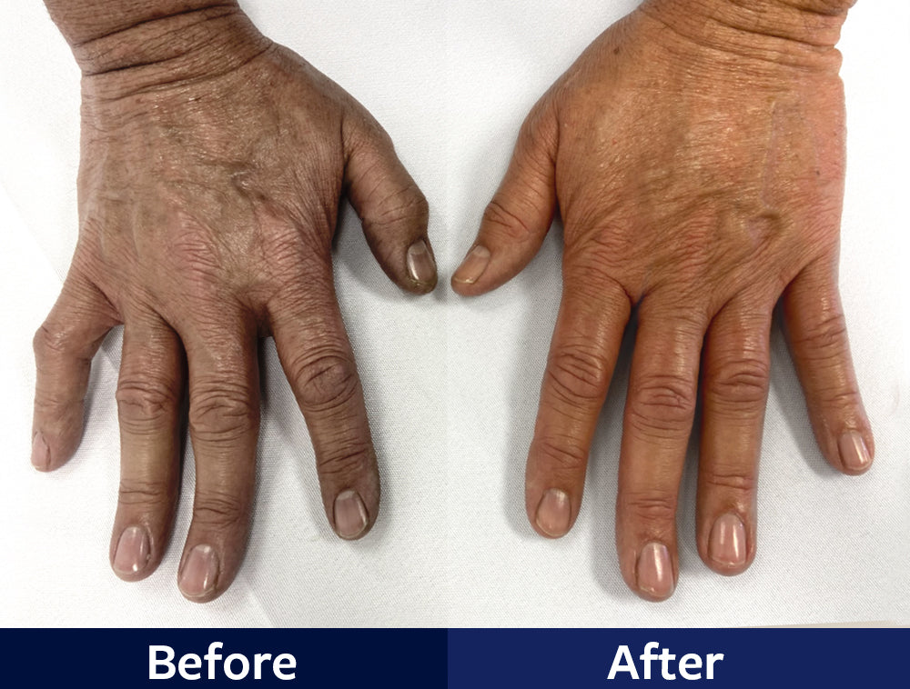 Mans hands before and after a paraffin wax treatment